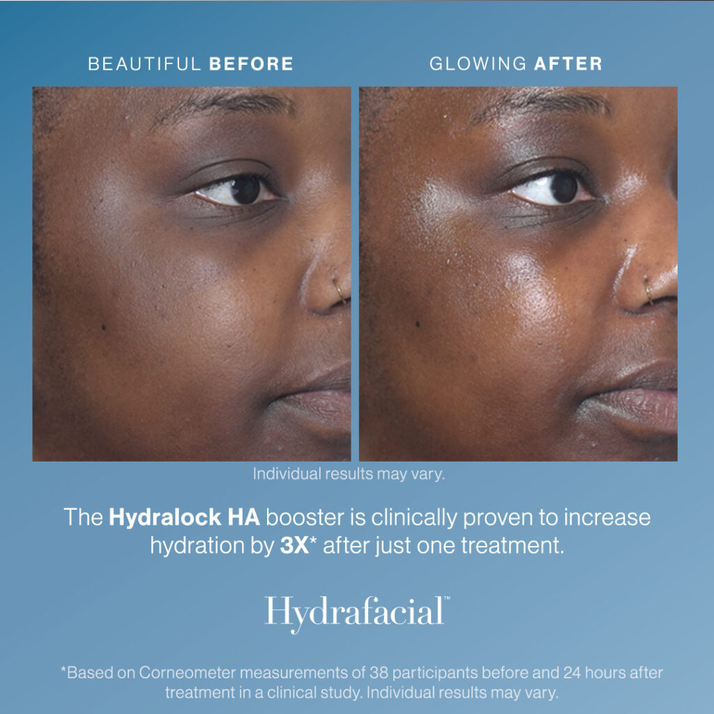 Hydralock_Before_After_1